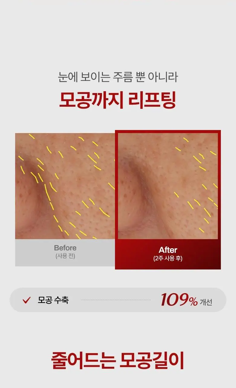 [탄력 리프팅] 메디테라피 링클핏 마스크 7매입 상세페이지 12